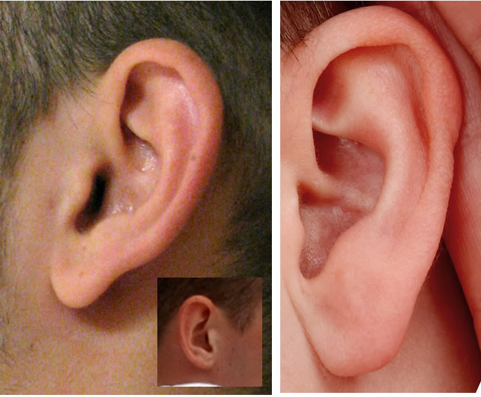 ear-drawing